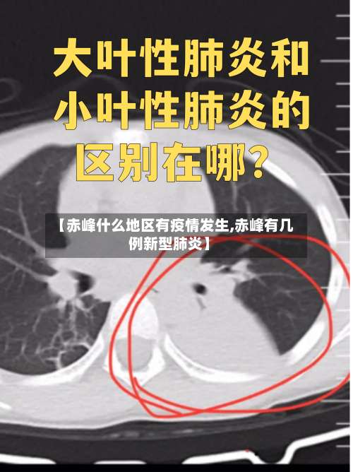 【赤峰什么地区有疫情发生,赤峰有几例新型肺炎】-第1张图片